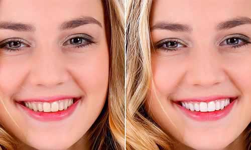 Consulta de Valoración Ortodóntica